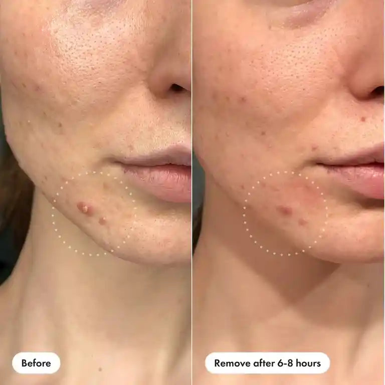 Skin Transformation Before and After