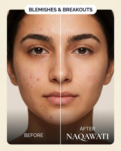 Naqawati™ Hydrocolloid Pimple Patches