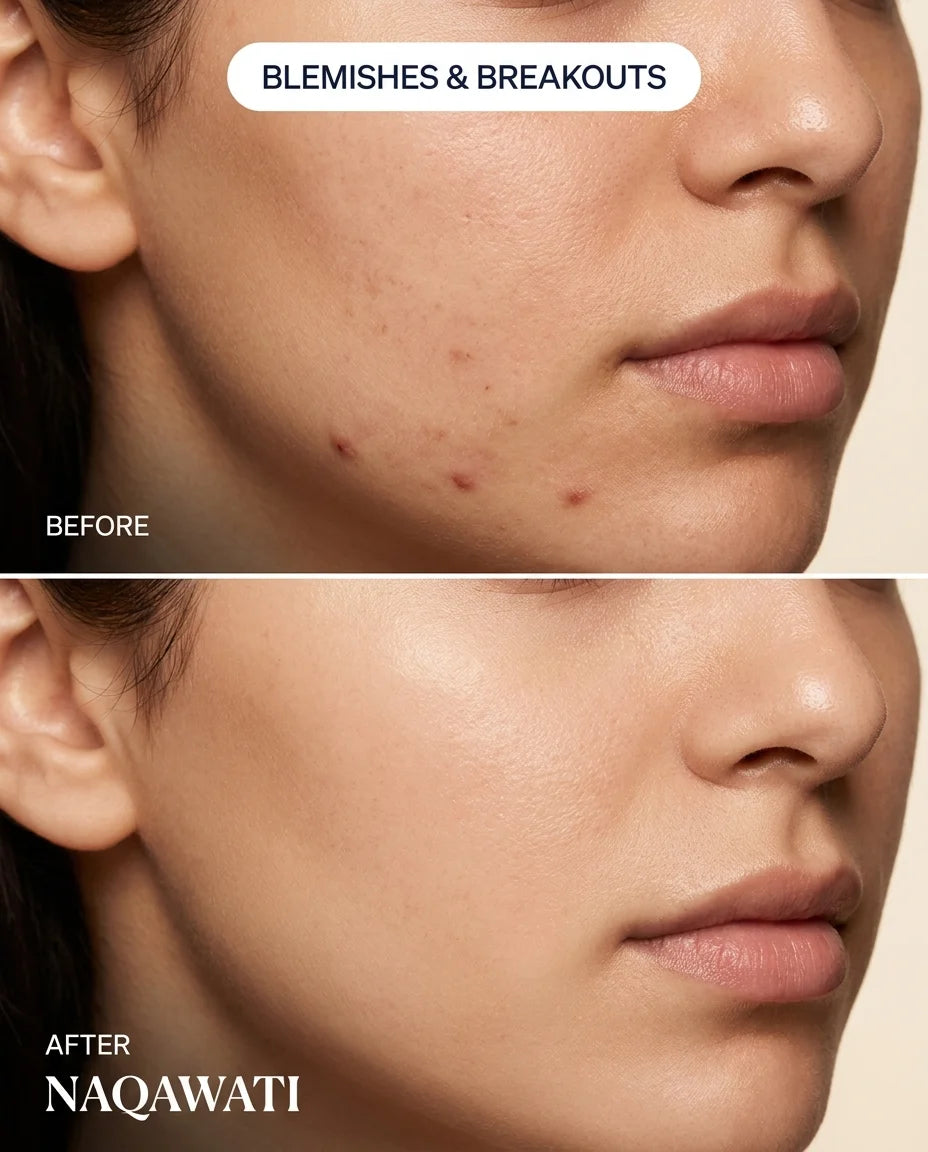 Naqawati™ Hydrocolloid Pimple Patches